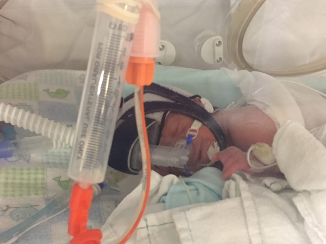 Day 24 – Aiden’s&nbsp;Smile