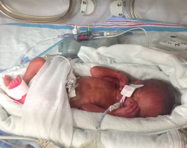 If you deliver a premature&nbsp;baby…